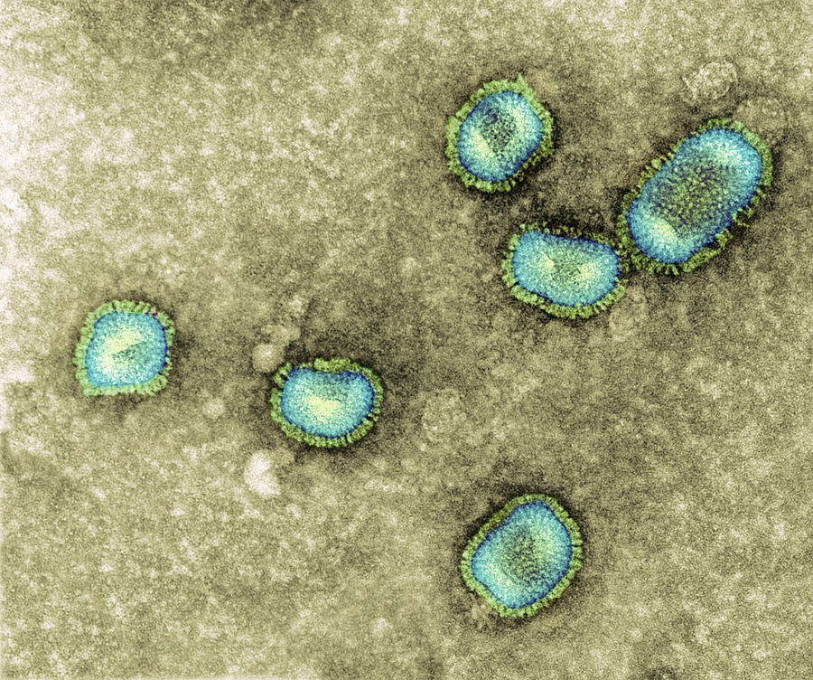 Influenzavirus B