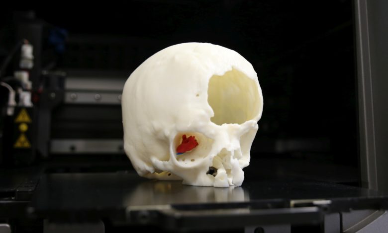 Cranio Stampa 3D/Meyer
