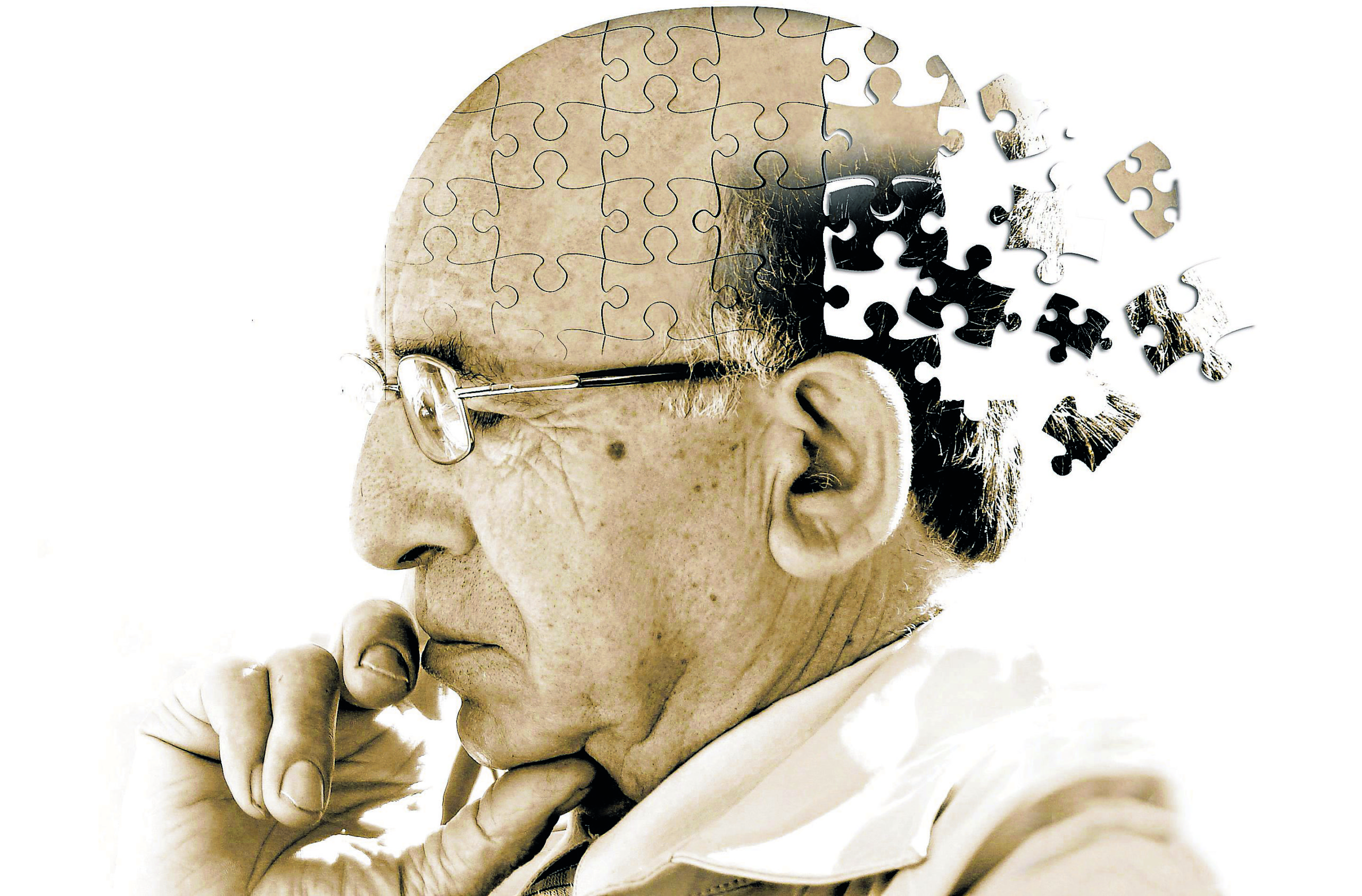 Alzheimer san severo