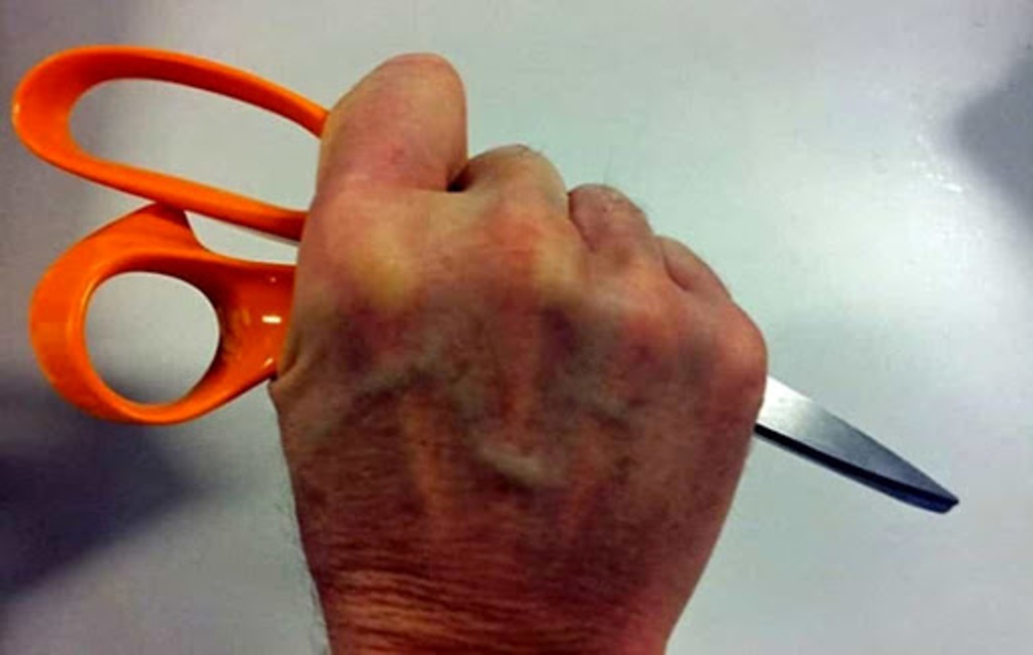 apricena-aggressione-forbici